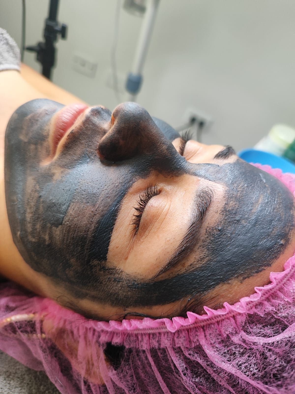 Tratamientos Faciales — foto 1